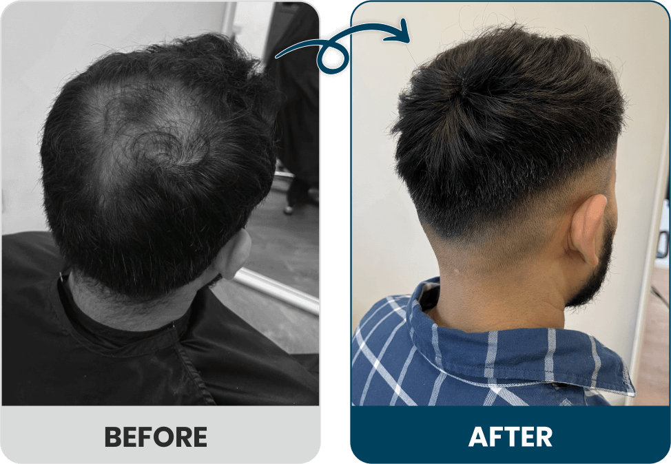 Men's Hair Systems Before & After Look