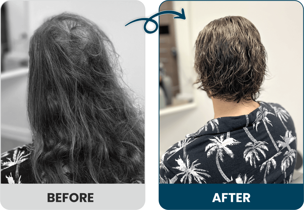 Men's Hair Systems Before & After Look