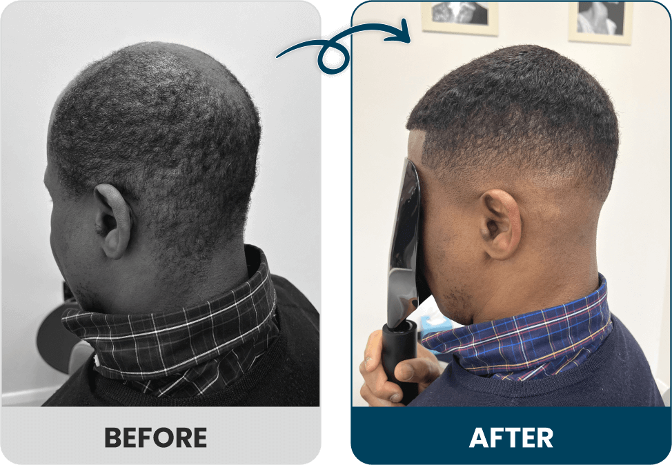 Men's Hair Systems Before & After Look