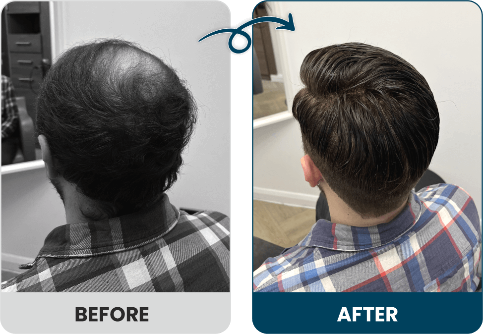 Men's Hair Systems Before & After Look