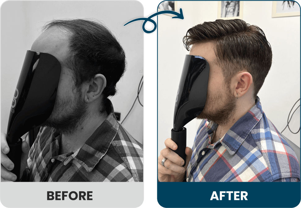 Men's Hair Systems Before & After Look