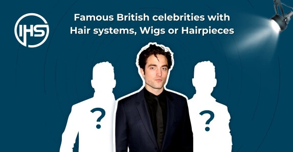 Famous British celebrities with hair systems, Wigs or hairpieces