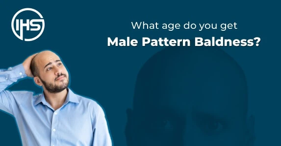 What age do you get male pattern baldness?