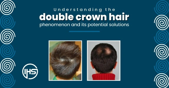 Understanding the double crown hair phenomenon and its potential solutions