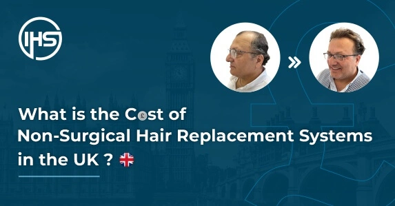 What is the Cost of Non-Surgical Hair Replacement Systems in the UK?