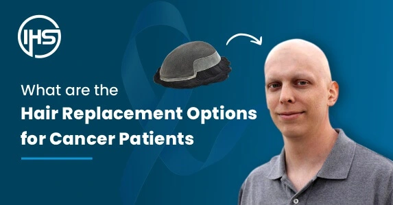 What Are the Hair Replacement Options for Cancer Patients?