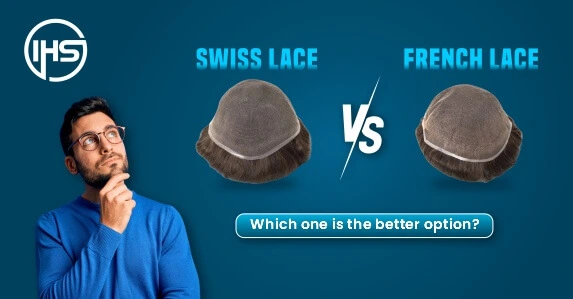French Lace vs Swiss Lace, which one is the better option?