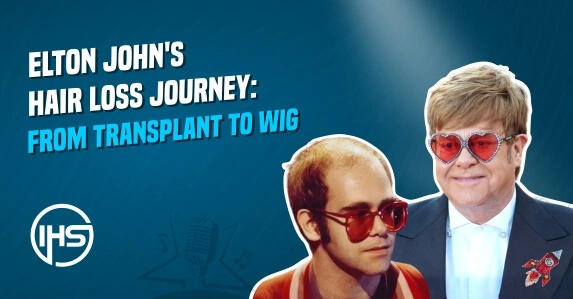Elton John’s Hair Loss Journey: From Transplant to Wig