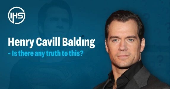 Henry Cavill Balding – Is there any truth to this?